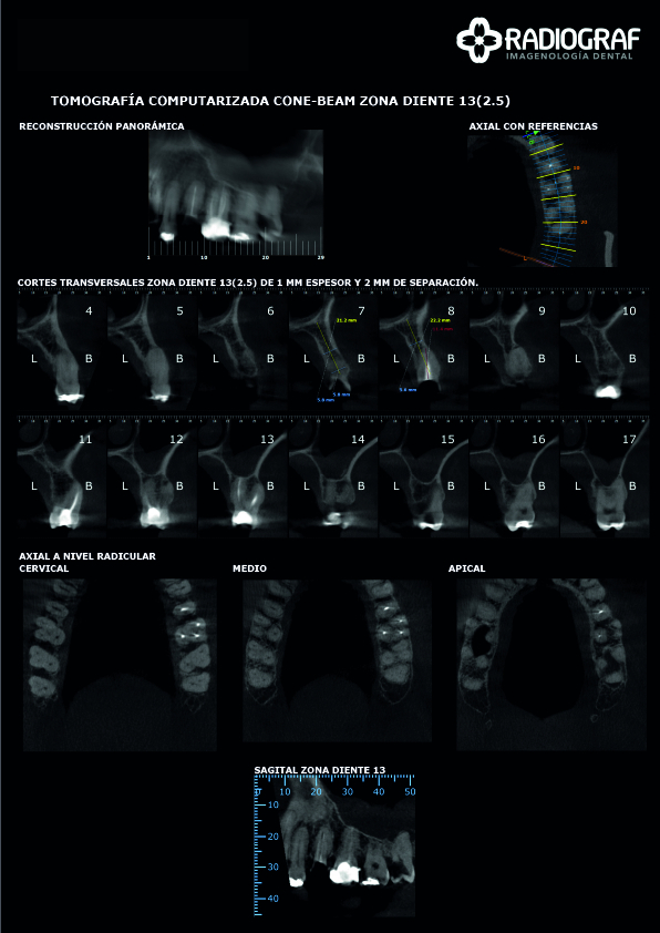 Tomografía Cone Beam – Scanner 3D