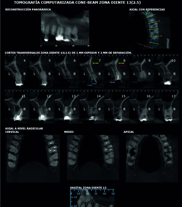 Tomografía Cone Beam – Scanner 3D